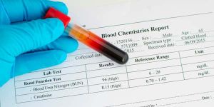 تحاليل تجلط الدم