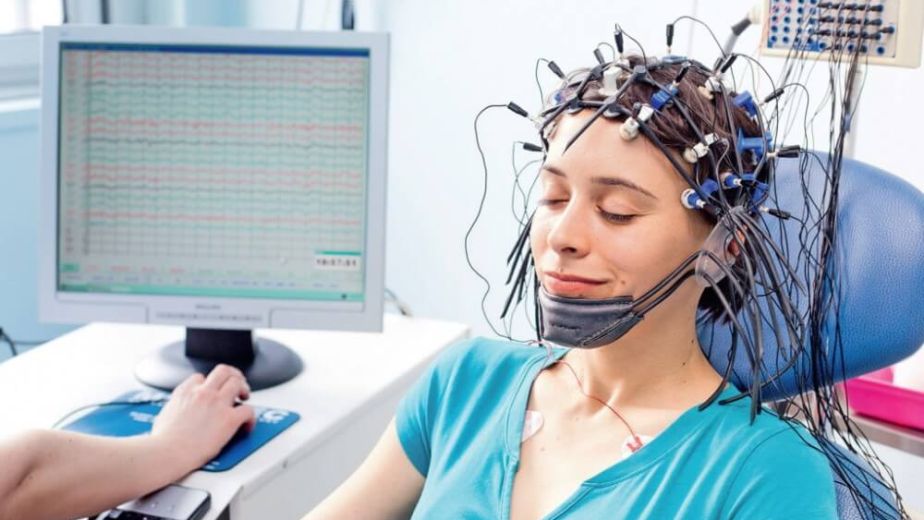 اشعة رسم المخ