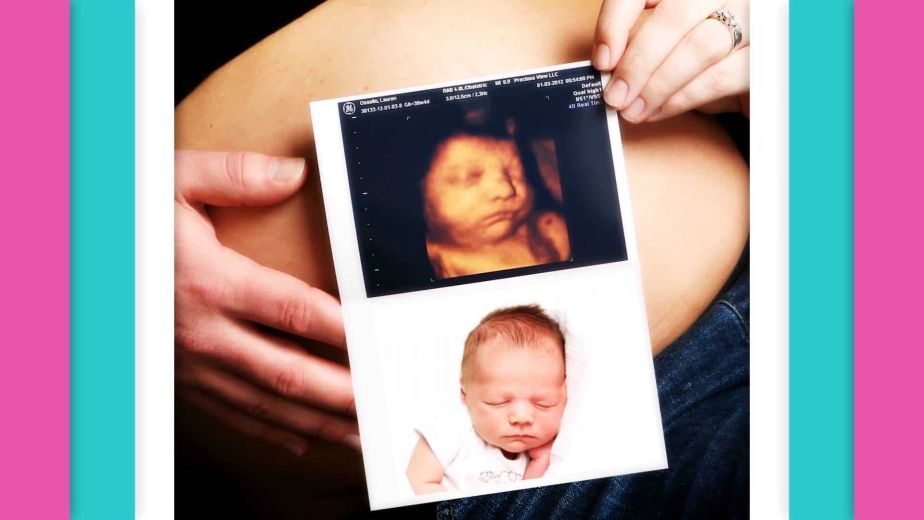 ما هو الدوبلر الملون للحامل