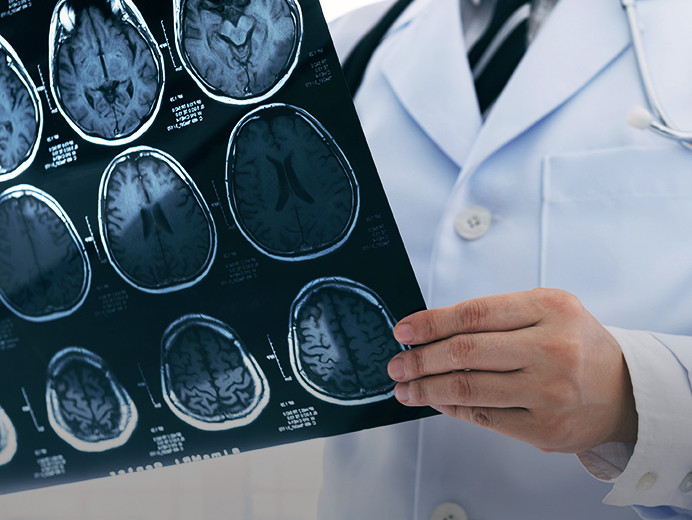 تشخيص أمراض المخ والأعصاب