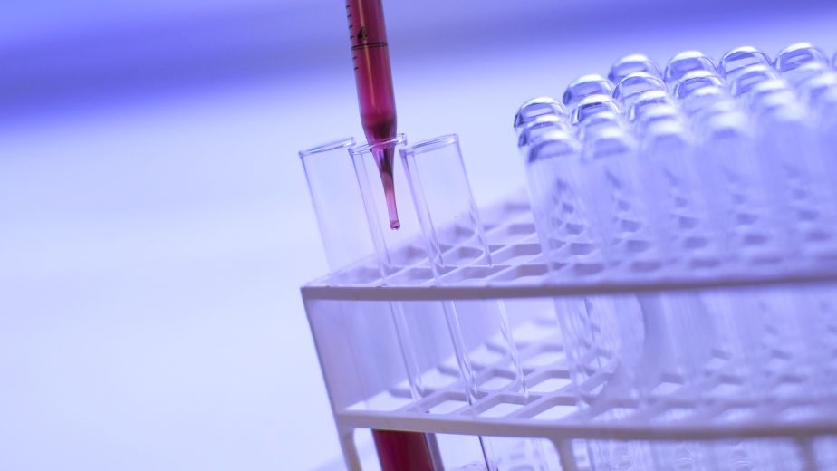 فحص انزيم القلب