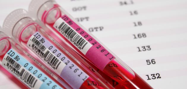 متي يتم استخدام تحليل الكبد