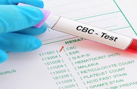 ما هو تحليل cbc