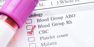 ما هو تحليل cbc