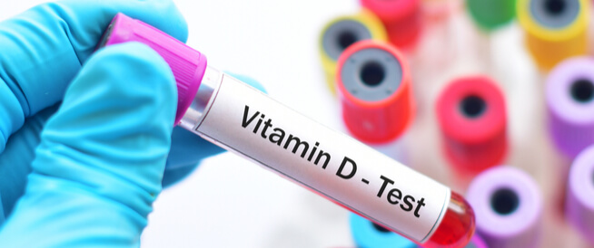 تحليل فيتامين د