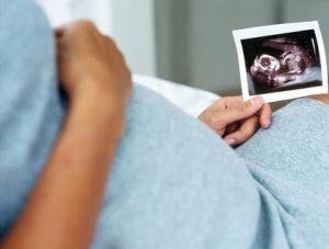 جهاز الدوبلر الملون اشعه رباعية الابعاد