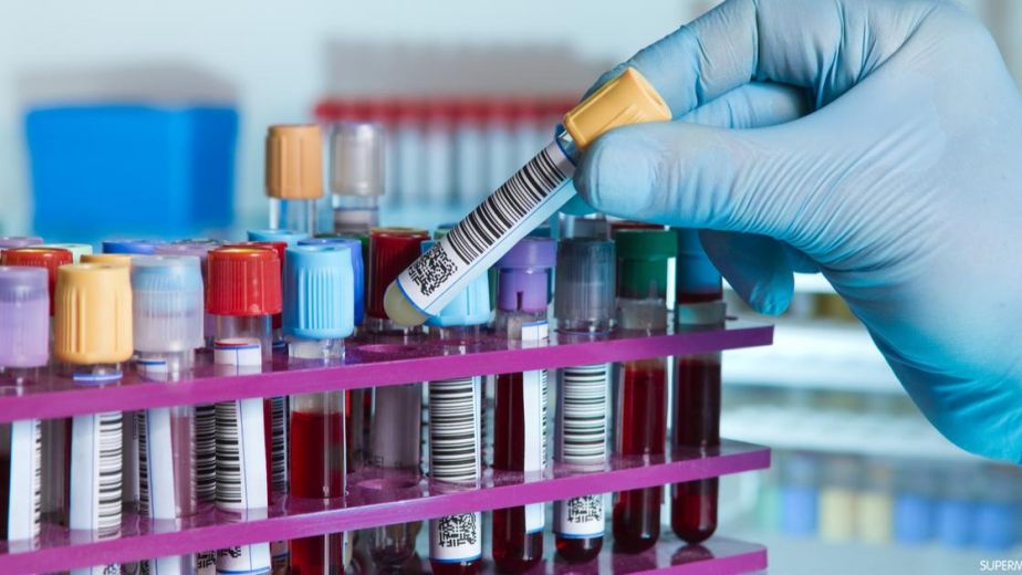 افضل مكان لعمل اشعة