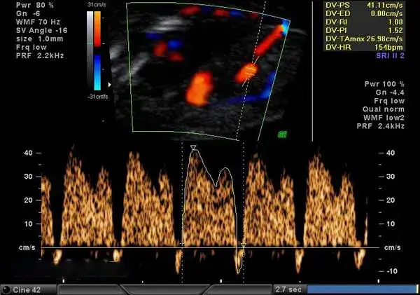 سعر اشعة الدوبلر الملون