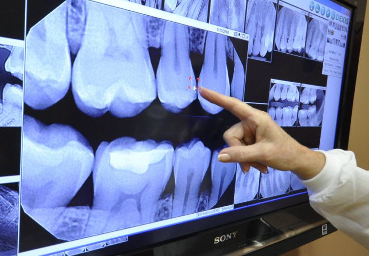 اشعة بانوراما الاسنان بالقاهرة