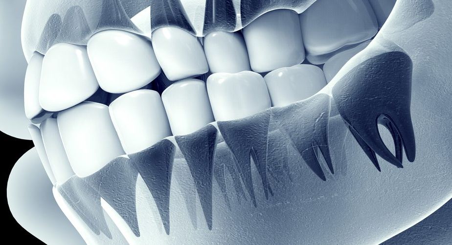 تكلفة اشعة بانوراما للاسنان