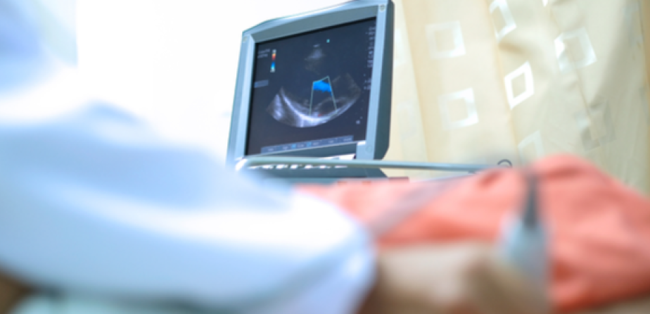 مراكز أشعة موجات صوتية على القلب