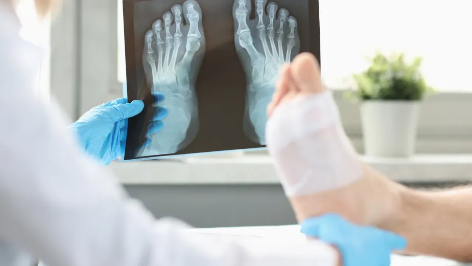 أشعة دوبلر على الرجل