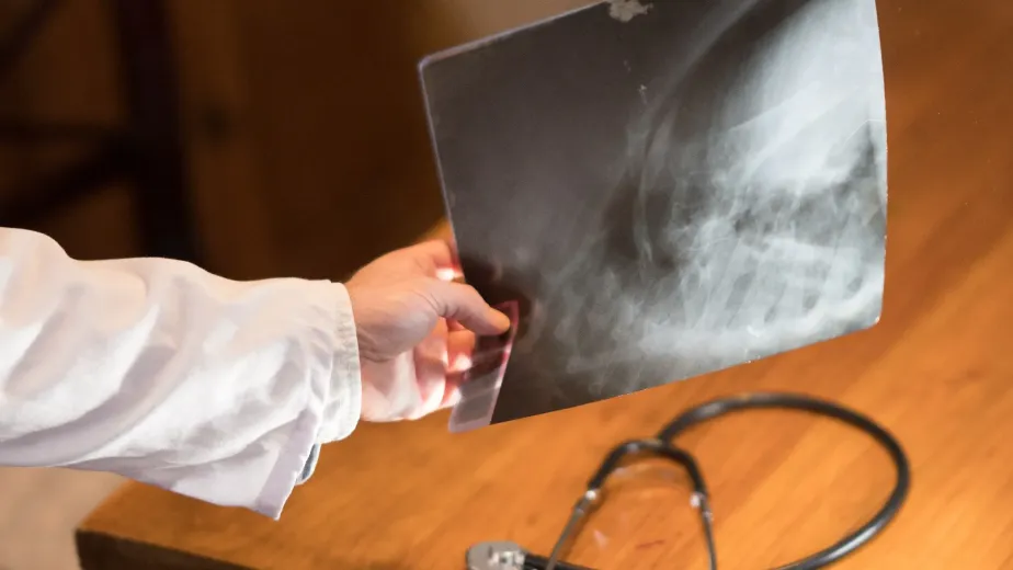 أشعة دوبلر على الشرايين والأوردة