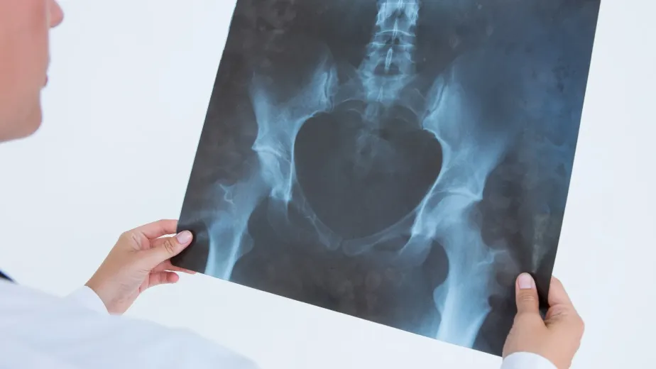 أشعة الدوبلر على الخصيتين