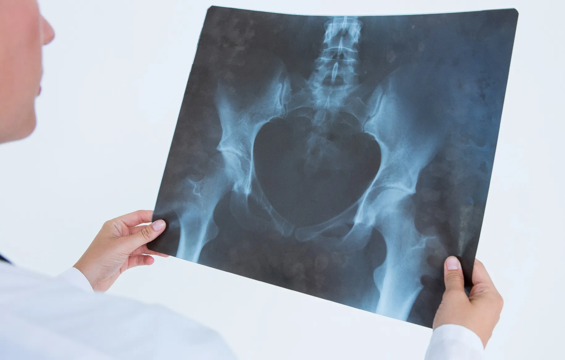 أشعة الدوبلر على الخصيتين