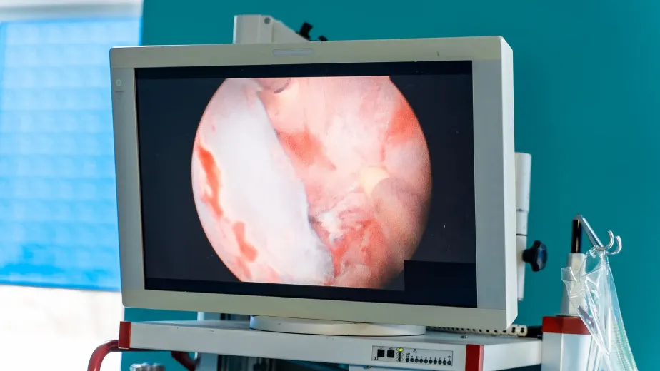 أشعة دوبلر على الشرايين والأوردة