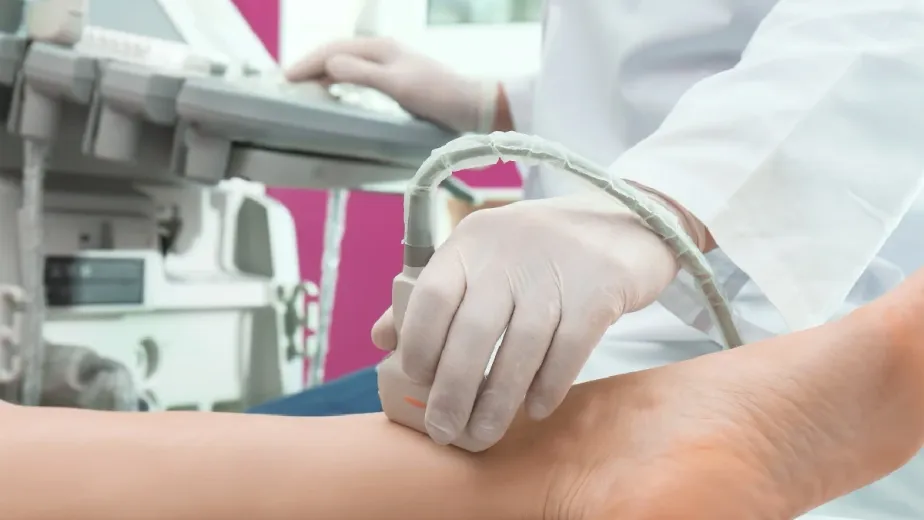 دوبلر الاوعية الطرفية